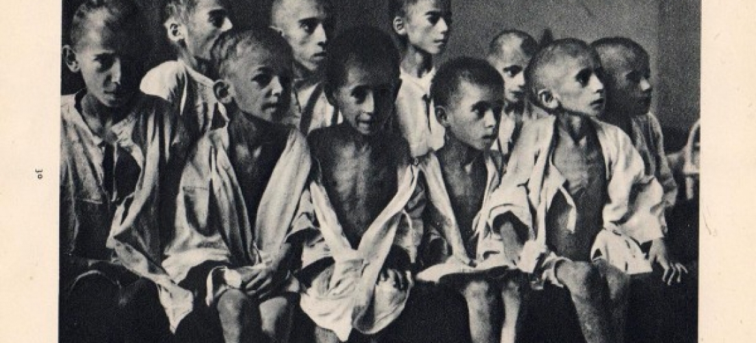 Παιδιά σκελετωμένα από την πείνα